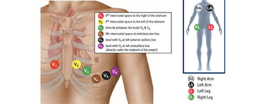 Why Does a 12-Lead ECG Only Use 10 Electrodes?