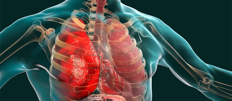 Can Stress Cause Low Oxygen Levels?