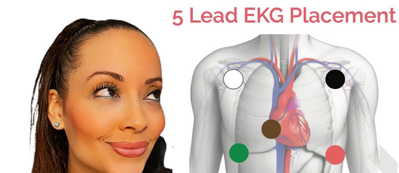 Why Use a 5-Lead ECG?