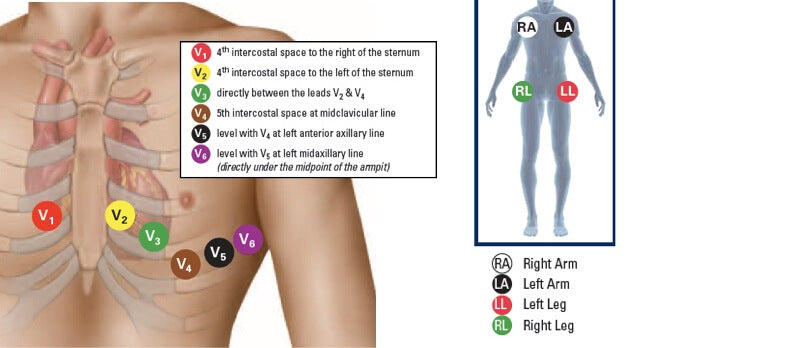 How to Do an ECG Step by Step