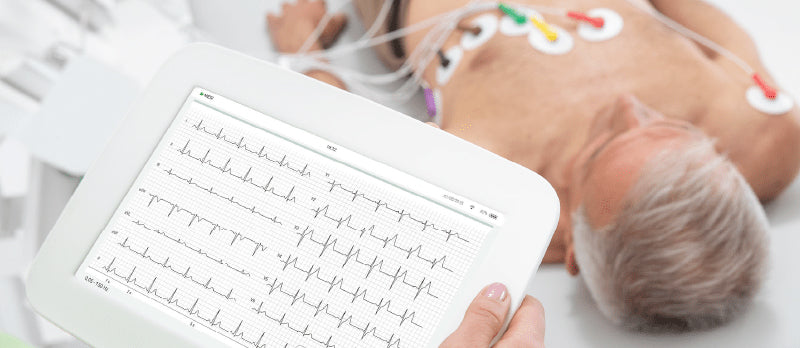 How to Read an ECG for Beginners (Simple Step-by-Step Guide)
