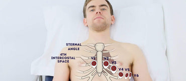 How Many Leads Is a Normal ECG?