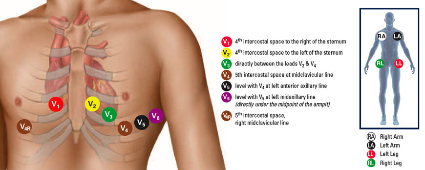How to Place 12-Lead EKG Electrodes (Step-by-Step Guide with Diagram ...